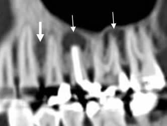 Resized Image