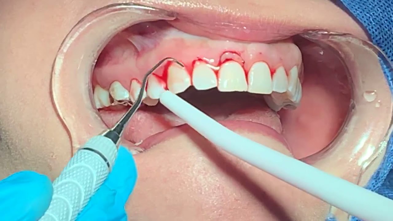Resized Image