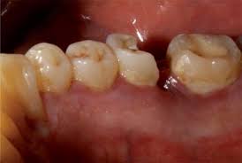 Resized Image
