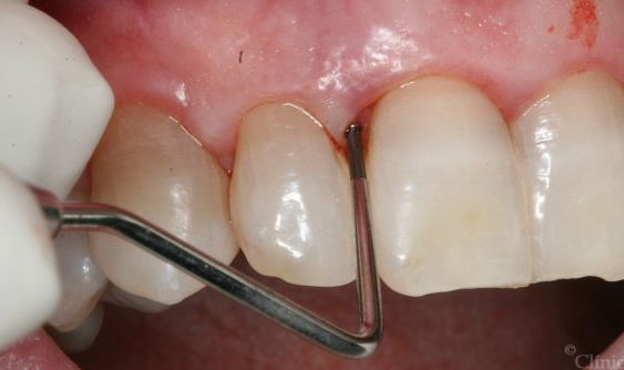 Resized Image