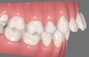 Resized Image