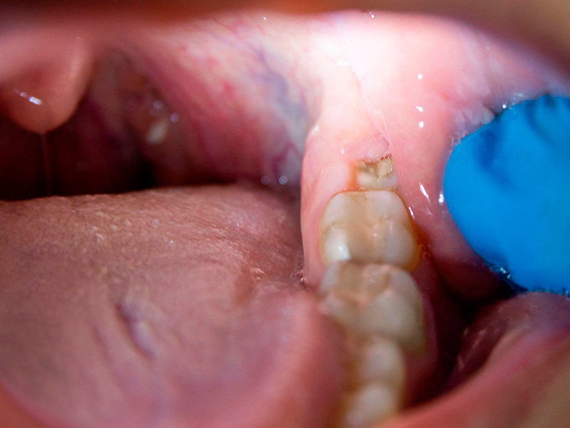 Solución quirúrgica maxilofacial