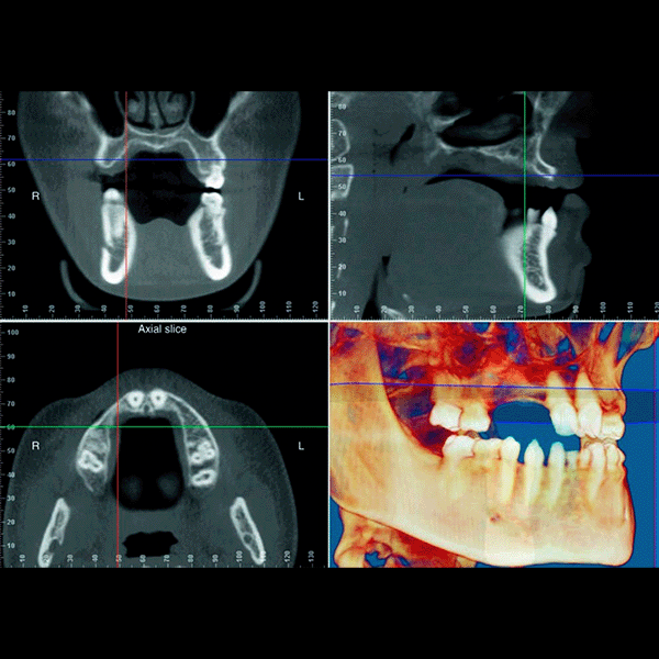 Tecnología Dental 3D